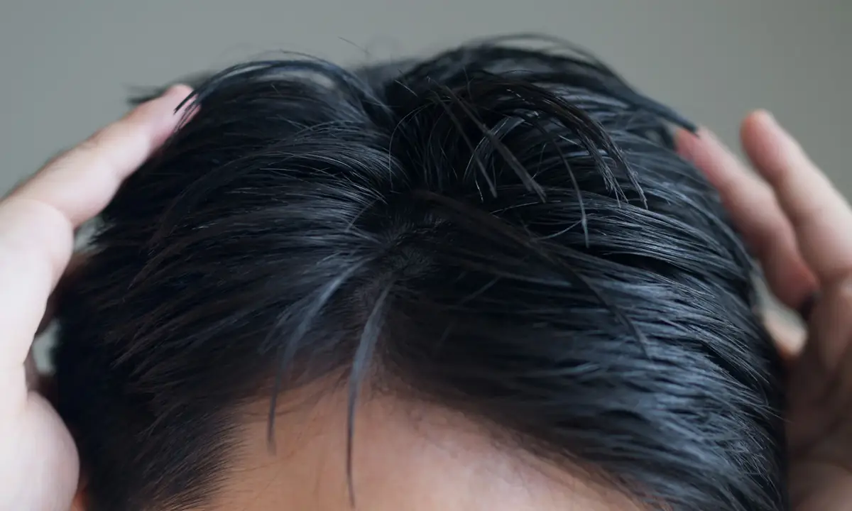 black scalp lotion